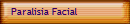 Paralisia Facial